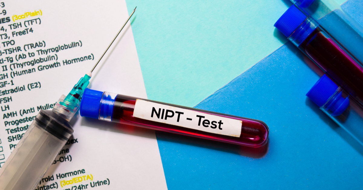 nipt testi nedir, nipt testi, nipt testi fiyat 2021, nipt testi fiyat, nipt testi nedir, nipt testi sonucu, nipt testi nerede yapılır, nipt testi yaptıranlar