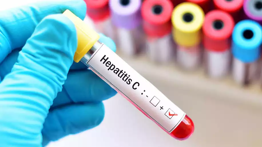 Hepatit C Hamilelikte Bebeğe Bulaşır mı?