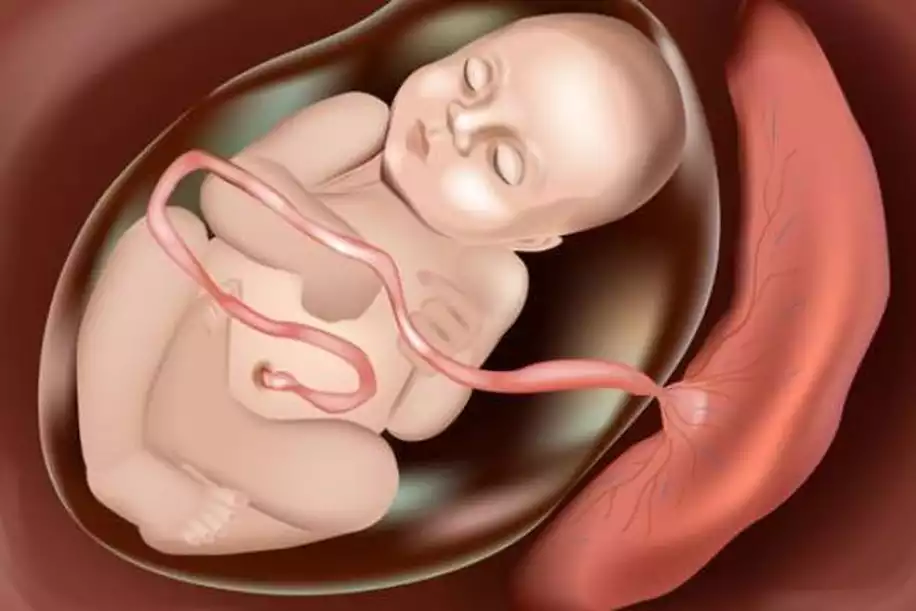 Plasenta Yaşlanması (Kireçlenmesi) Nedir?
