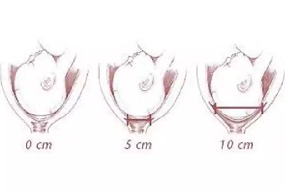 Açılma Başladıktan Ne Kadar Sonra Doğum Gerçekleşir?