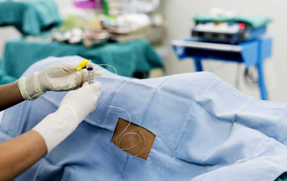 Epidural Anestezi İle Ağrısız Normal Doğum ve Yan Etkileri