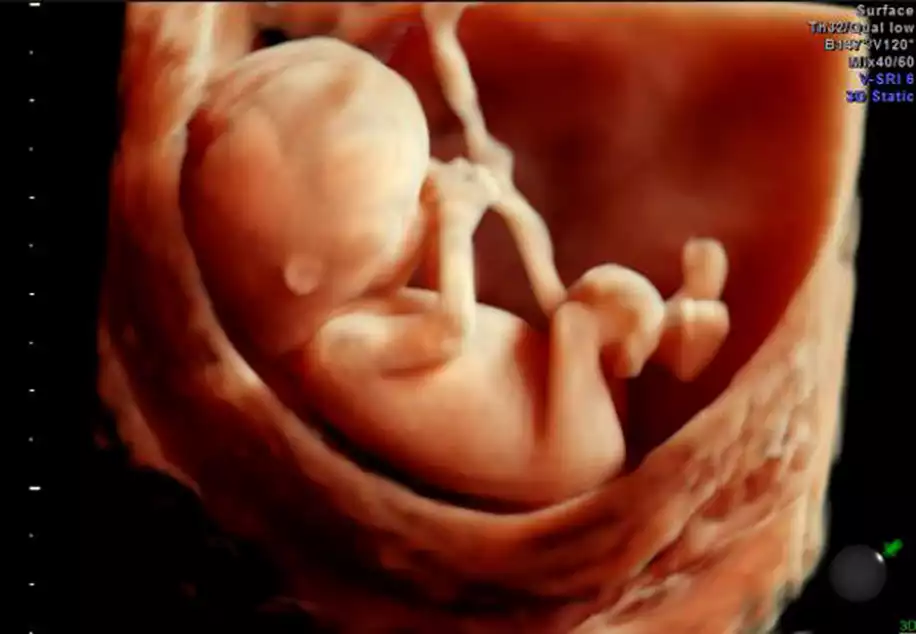 4 Boyutlu Ultrason Gebeliğin Kaçıncı Haftasında Çekilir?