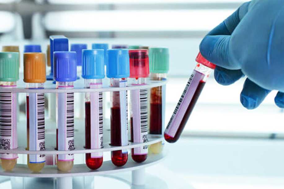 6 Soruda Doğum Öncesi Genetik Tanı Testi