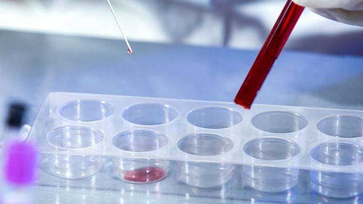 HIV/AIDS Testi Nedir?