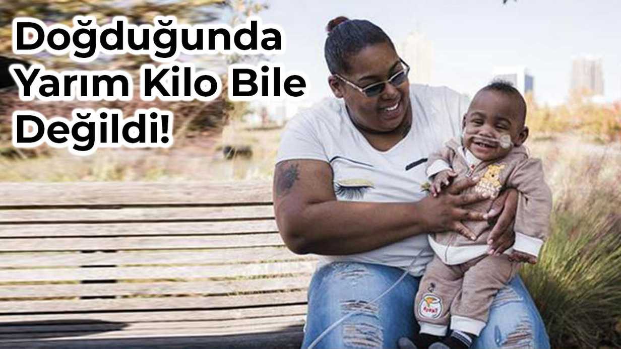 Prematüre Doğan Curtis Bebek Guinness Rekorlar Kitabında!