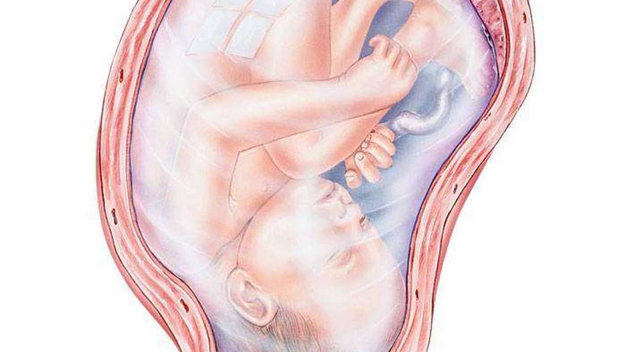 Amniyon Kesesi Nedir?