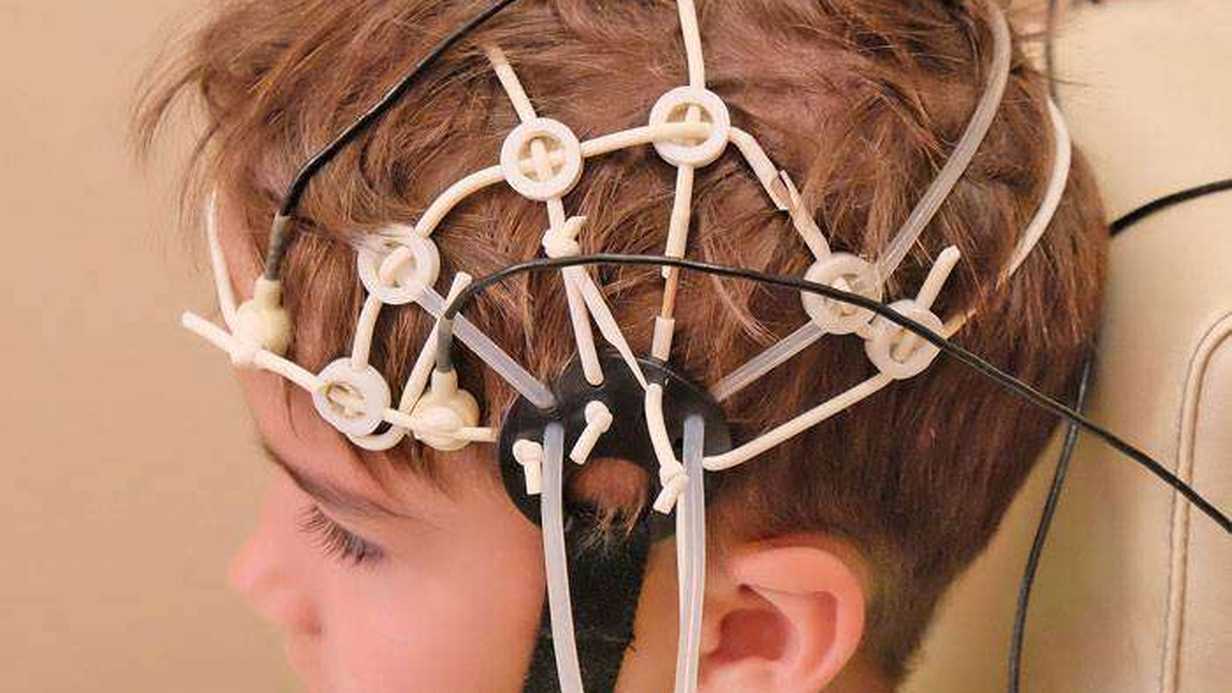 Elektroensefalogram (EEG) Nedir?