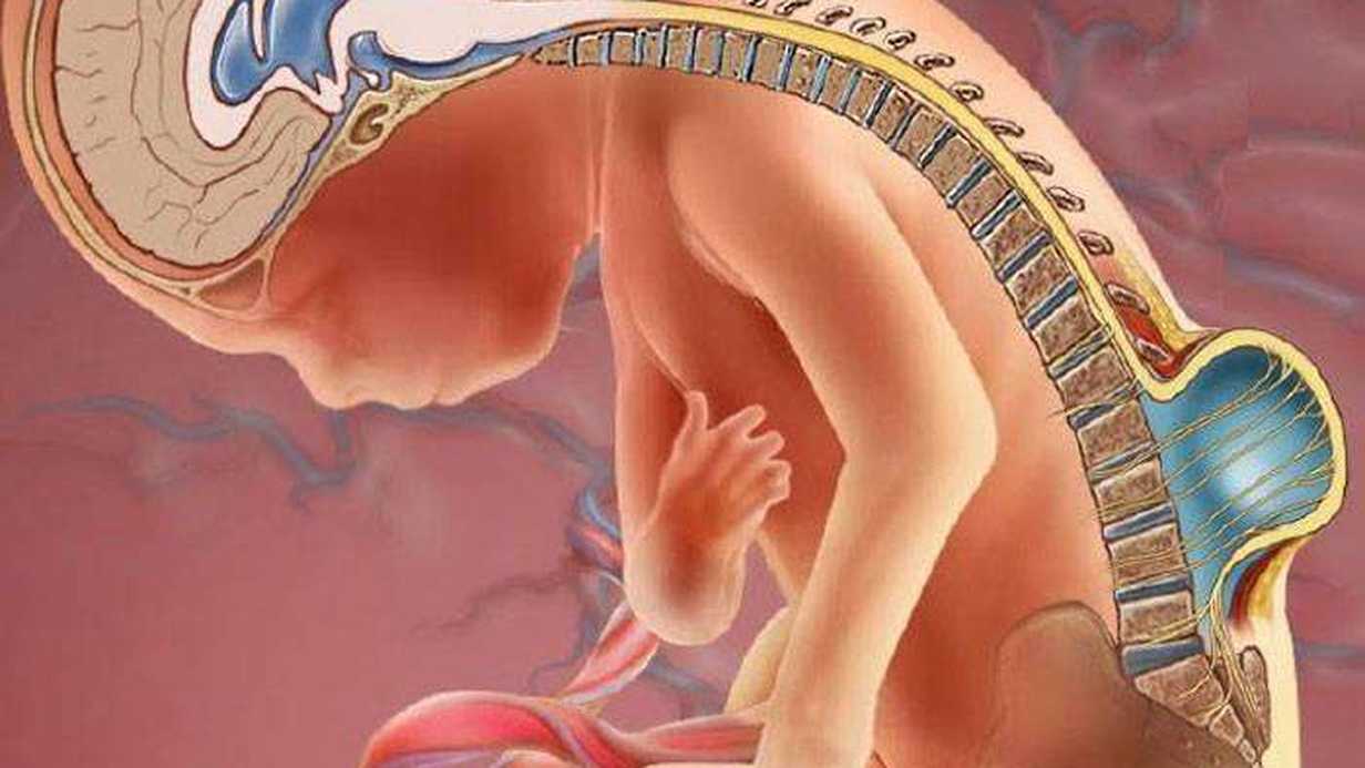 Meningomiyelosel Nedir?