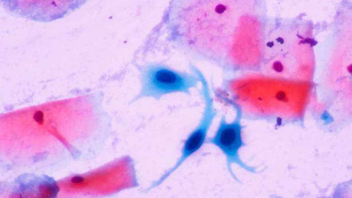 Metaplazi Nedir?
