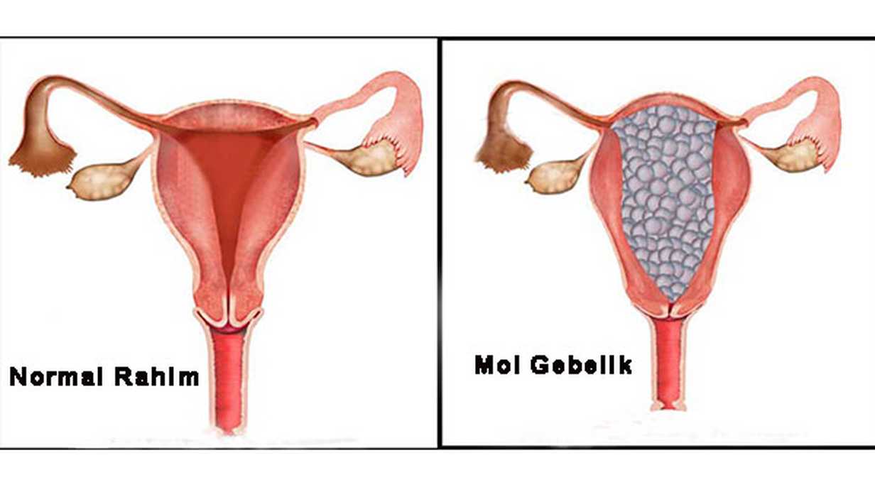 Mol Gebelik Sonrası Hamilelik İçin Ne Kadar Beklenmeli?