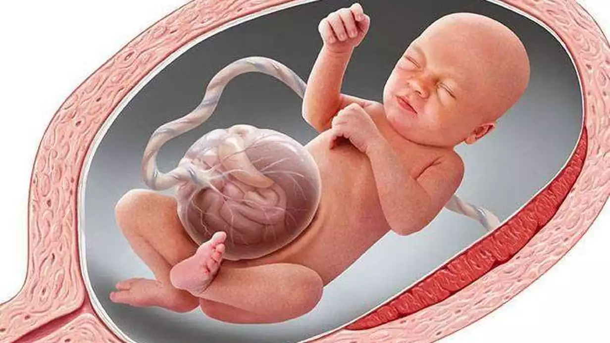 Omfalosel Nedir?
