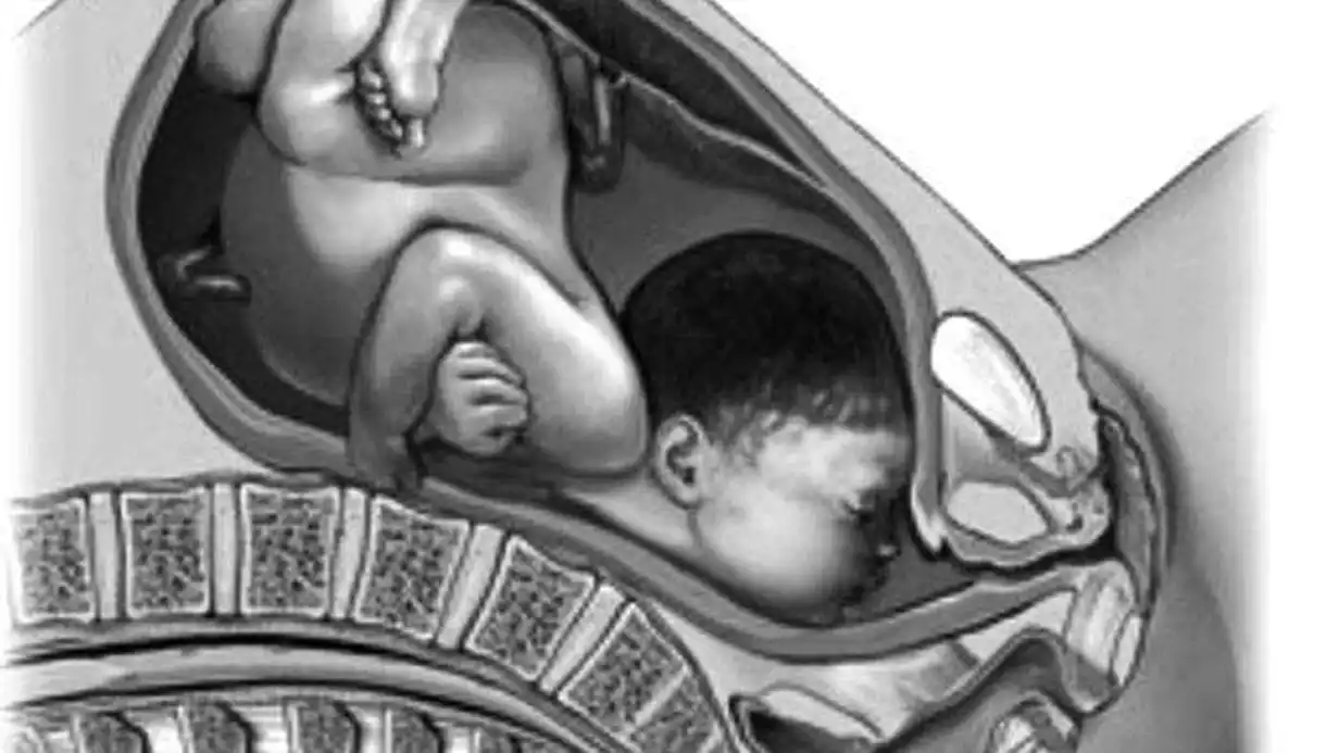 Yüz Prezentasyonu Nedir?