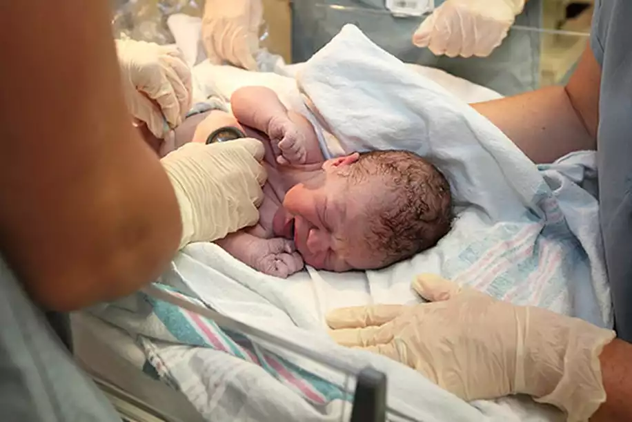 Doğumdan Sonra Bebeğin Kafasındaki Şekil Bozukluğu & Şişlik