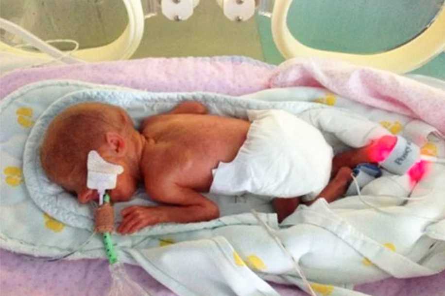 Dünyaya 16 Hafta Erken Gelen Edie’nin Hayata Tutunma Hikâyesi