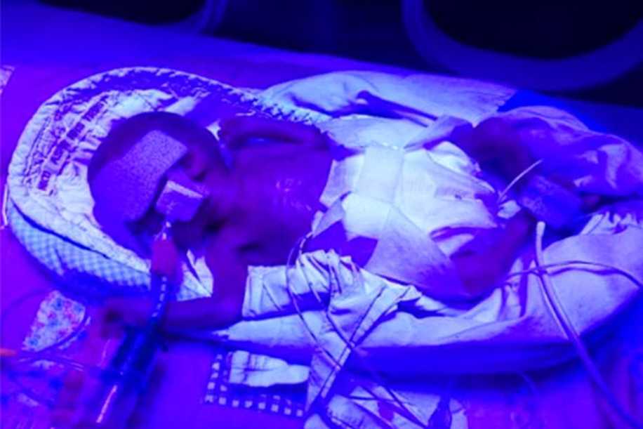 Dünyaya 16 Hafta Erken Gelen Edie’nin Hayata Tutunma Hikâyesi